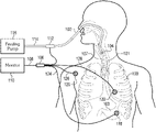 Gastric residual volume measuring device diagram